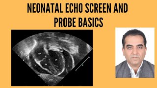 Neonatal echo-Echo screen and probe basics. Dr Mohit Sahni #pocus #echo #echoviews