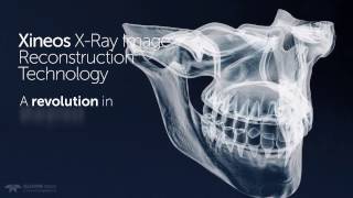 Xineos X-Ray Image Reconstruction Technology