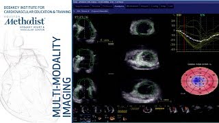 Principles of Echo Doppler (William A. Zoghbi, MD) September 18, 2018