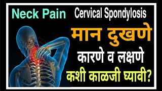 Cervical Spondylosis|Neck Pain|मान दुखणे,कारणे व लक्षणे.कशी काळजी घ्यावी?|576|@drramjawale