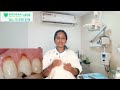 சரியான பல் துலக்கும் முறை right way to brush your teeth mithran dental chennai adyar