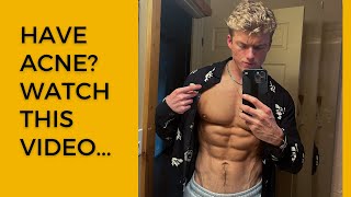 My Experience with Acne and Accutane as a Natural Bodybuilder...