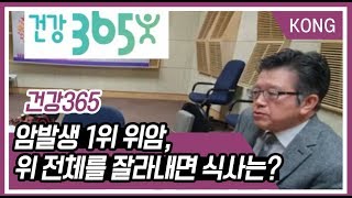 [박광식의 건강365]암발생 1위 위암, 위 전체를 잘라내면 식사는?