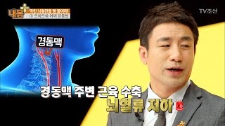 막힌 뇌혈관을 뚫어주는 으쓱으쓱 운동법! [내 몸 플러스] 53회 20170409