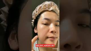 how to stop hair fall immediately at home for female trends 2022/hair mask/hair fall reasons stop