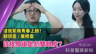 什麼狀況下割雙眼皮反而更糟？上額年輕化治療原則「鬆弛下垂」優先解決 上額拉皮/切眉/提眉完整分析 科普醫美新知 178-20201030