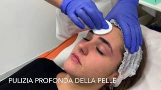 Peeling viso