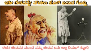 Schlitzie ಇವರ ಜೀವನದ ಒಂದು ರಿಯಲ್ ಸ್ಟೋರಿ ನಿಜವಾಗಿಯೂ ಇವರ ಜೀವನದ ಮುಂದೆ ನಮ್ಮ ಜೀವನ ಏನು ಅಲ್ಲ