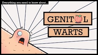GENITAL WARTS, Causes, Signs and Symptoms, Diagnosis and Treatment.