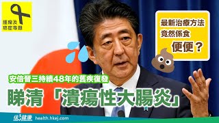 【安倍請辭】治潰痬性結腸炎 最新療法係食便便?!