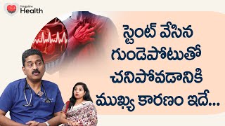 Heart Stents | స్టెంట్ వేసిన గుండెపోటుతో చనిపోవడానికి కారణం.. Dr. A. Sreenivas Kumar TeluguOneHealth