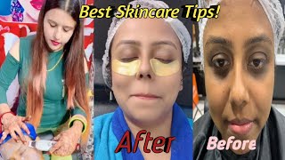 Skincare Tips! Tutorial video!Dark Circles! Blackheads! Skin Tightening \u0026 Whitening Glowing!Homecare