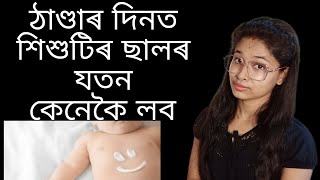 Winter Skin Care For Kids in Assamese..ঠাণ্ডাৰ দিনত শিশুৰ ছালৰ যতন