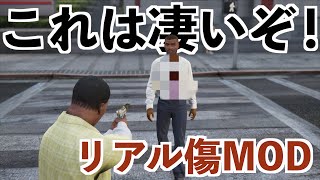 【リアル傷MODを入れてフランクリンを究極に傷つけてみた】GTA5実況MOD