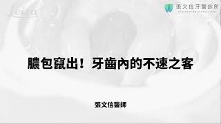 😱膿包竄出！牙齒內的不速之客 ☕｜張文信牙醫診所/台中顯微根管治療大師/顯微根管/DSD數位美齒 /DSD微笑設計/張文信牙醫/台中牙醫/台中DSD微笑設計推薦/台中顯微根管治療推薦