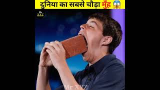 इस बच्चे का मुँह देख हैरान हो जाओगे😱 world'sargest mouth gape/ amazing fact /