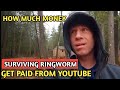 SURVIVING RINGWORM || HOW MUCH MONEY DOES SURVIVING RINGWORM CHANNEL EARN FROM YOUTUBE