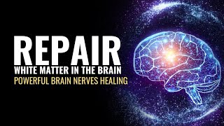 Repair White Matter In The Brain | Cognition Enhancer | Powerful Brain Nerves Healing Sound Therapy