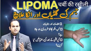 What is Lipoma? | چربی کی گلٹی | Symptoms \u0026 Treatment | Surgeon Dr Imtiaz Hussain