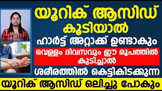 വെള്ളം ദിവസവും ഈ രൂപത്തിൽ കുടിച്ചാൽ  ശരീരത്തിൽ കെട്ടി കിടക്കുന്ന യൂറിക് ആസിഡ് താനേ പോവും