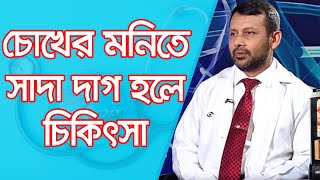 চোখের মনিতে সাদা দাগ হলে চিকিৎসা