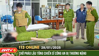 Thăm, động viên chiến sĩ Công an bị thương khi làm nhiệm vụ | Bản tin 113 online ngày 28/1 | ANTV