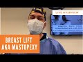 Mastopexy, Internal Capsulorraphy and Implants | Visage Clinic Toronto