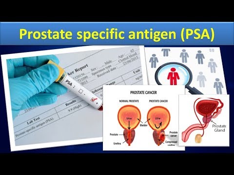 Prostate Specific Antigen(simple,clear Overview). - YouTube