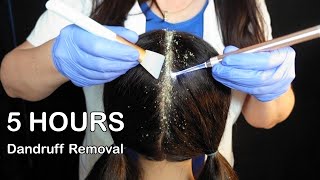 ASMR ~ 5 HOURS ~ Scalp Check with Bad Results & Dandruff Treatment (Whispered)