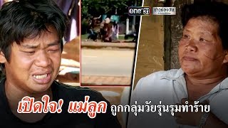 เปิดใจ! แม่ลูกถูกกลุ่มวัยรุ่นรุมทำร้าย | ข่าวช่องวัน | one31