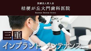 三重でインプラントのメンテナンスは評判の大門歯科医院