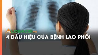 4 dấu hiệu của bệnh lao phổi