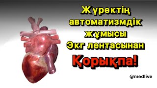 ЖҮРЕКТІҢ АВТОМАТИЗМДІК ӨТКІЗГІШ ЖҮЙЕСІ | ЭКГ ЭЛЕКТРОДТАРДЫ ҚОЮ.