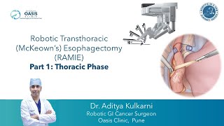 Robotic Transthoracic McKeowns Esophagectomy (RAMIE) | Esophageal Cancer Surgery| Dr.Aditya Kulkarni