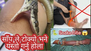 सर्प ले टोक्यो भने यस्तो गर्नु होला snake bite in nepal || nepali snake catcher