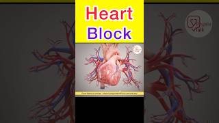 What is Heart Block ?