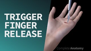 Trigger Finger Release