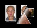 jeunesse luminesce cellular rejuvenation serum amazing before after photos