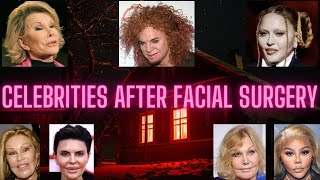 Shocking Celebrity Transformations: Unrecognizable After Plastic Surgery 😱✨