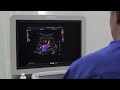 Doctor Examining Ultrasound Stock Video