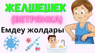 Желшешек ауруының емі / Зеленка қолданбаңыз