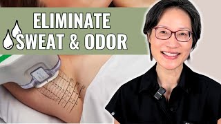 Why Miradry® Is the Best Treatment for Excessive Underarm Sweating (Hyperhidrosis)