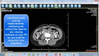 Medinexus Web portal