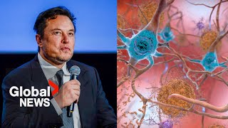 Elon Musk’s Neuralink wants to test brain chips in humans in “6 months”