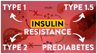 Insulin Resistance and Diabetes | Mastering Diabetes | Cyrus Khambatta