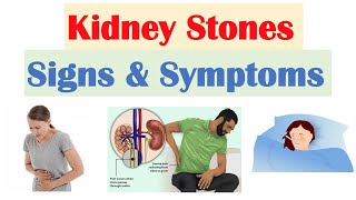 Kidney Stones (Nephrolithiasis) Signs & Symptoms | & Why They Occur