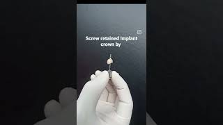 Jai Hind 🇮🇳 A screw retained Implant crown for a missing tooth by cosmetic dentist Dr Trivikram.