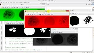 Matlab Code for Blood Group Detection Using Image Processing