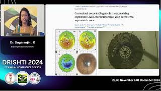 KSOS2024 IC40 T1 Dr Sugaranjini EXPLORING THE CORNEAL CHRONICLES