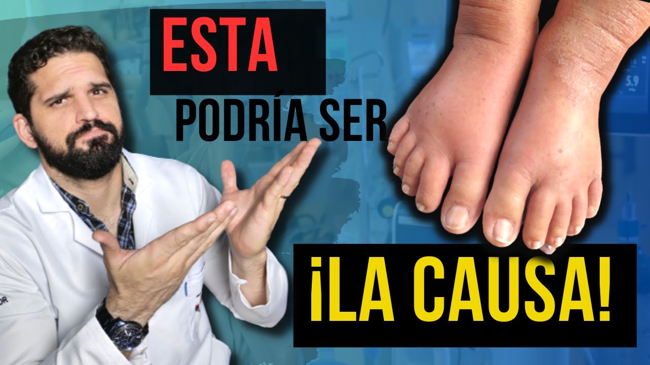 ¡MIRA! ¿Por Qué Tus PIERNAS Se HINCHAN? ¡Descubre Las Posibles Causas Y ...